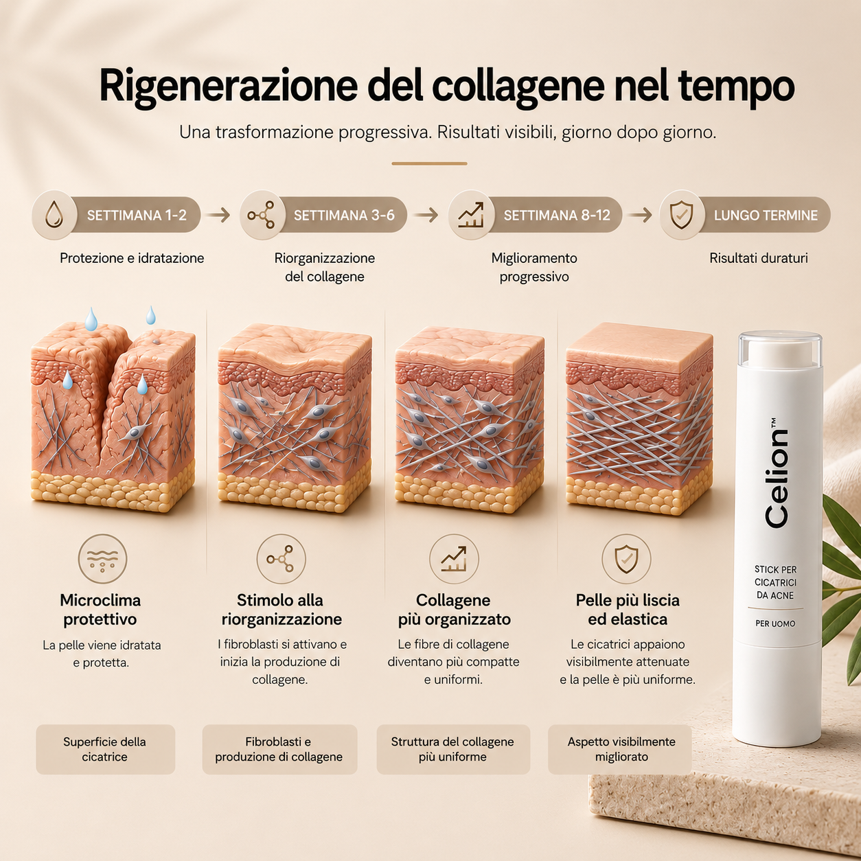 Celion™  Leviga le cicatrici da acne