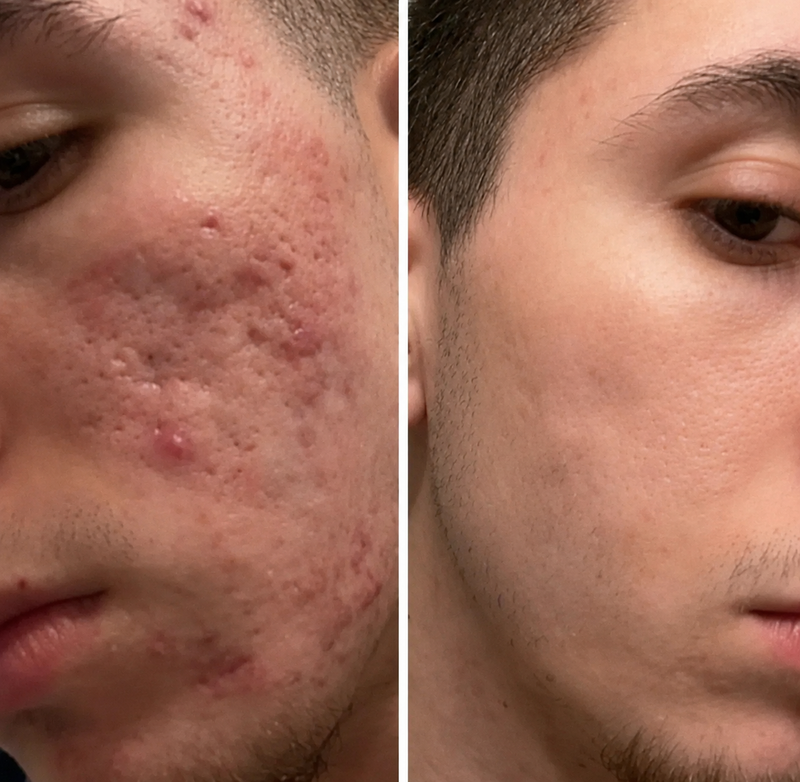 Prima e dopo