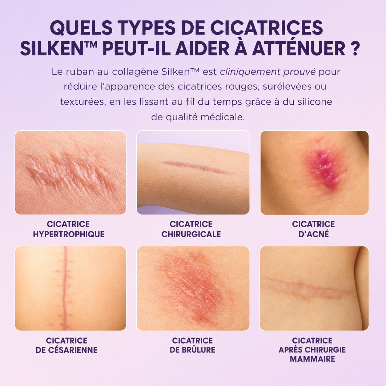 Silken™ Patchs en silicone