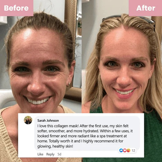 DermeEye™ Collagen Night Wrapping Mask