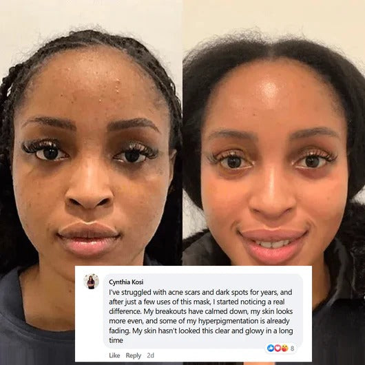 DermeEye™ Collagen Night Wrapping Mask